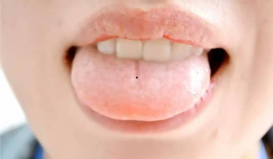 吃角瓜舌头痒,吃角瓜引发的神秘瘙痒之谜